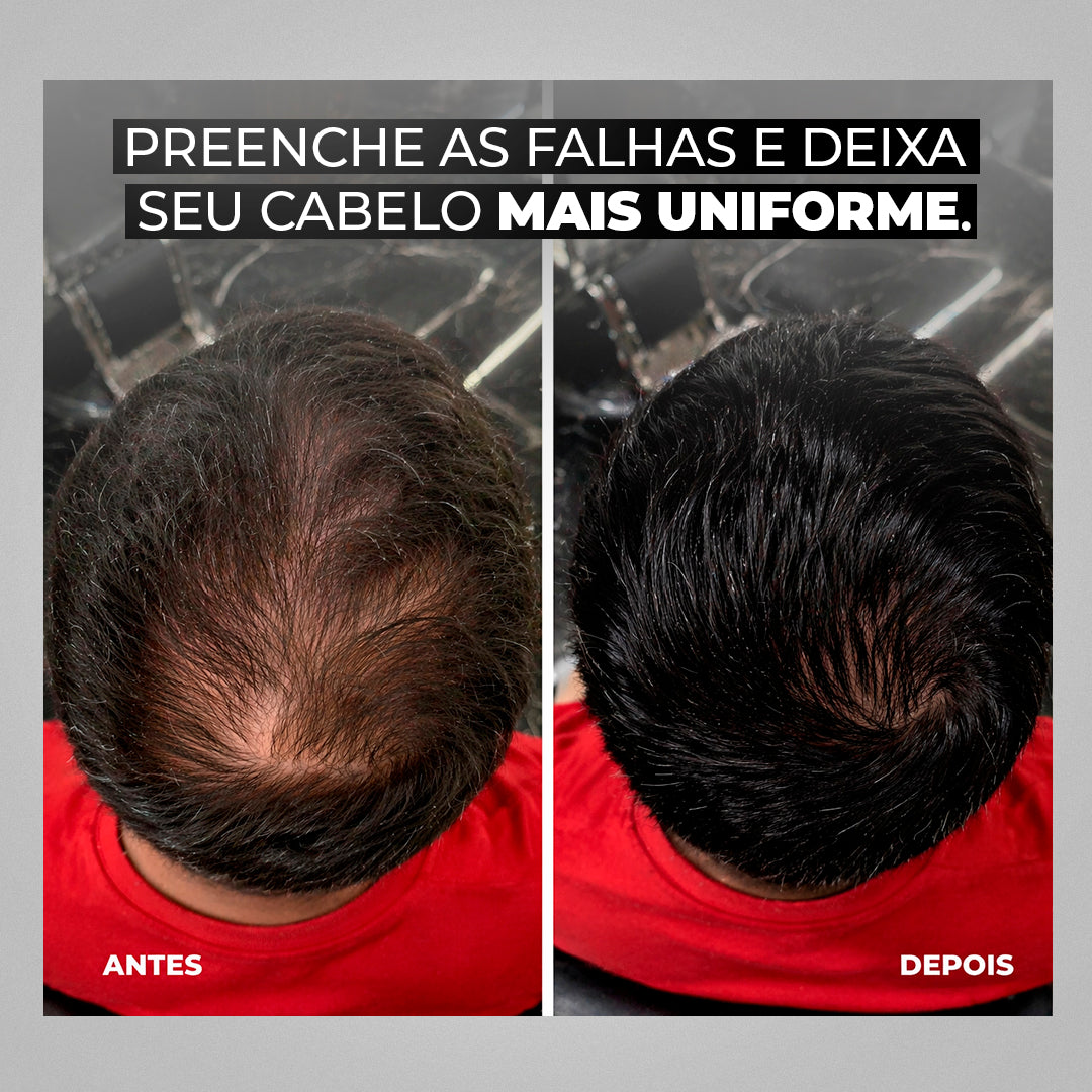 Modern Hair® – Camuflagem Capilar Profissional - Compre 1 e Leve 2