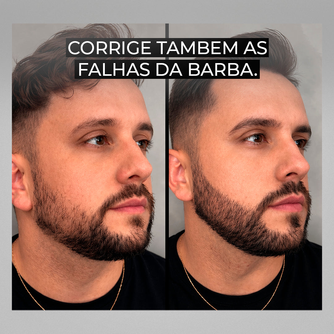 Modern Hair® – Camuflagem Capilar Profissional - Compre 1 e Leve 2